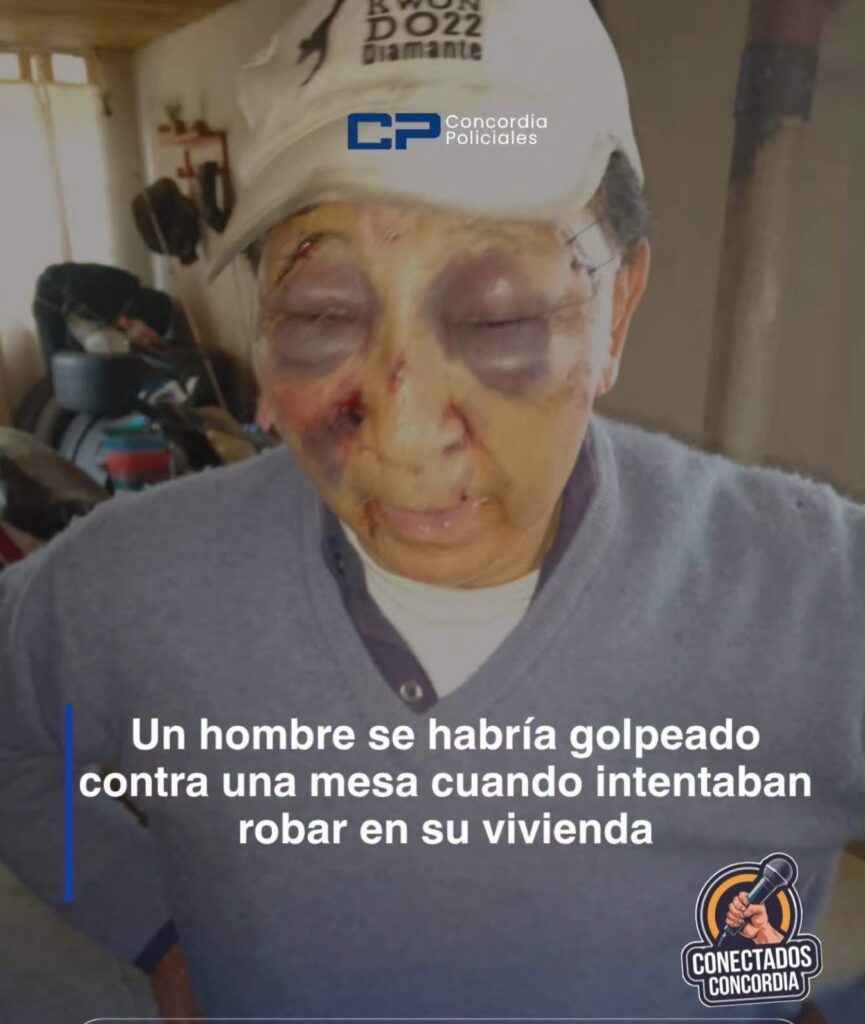 Un hombre se habría golpeado el rostro cuando robaban su vivienda - Conectados Concordia